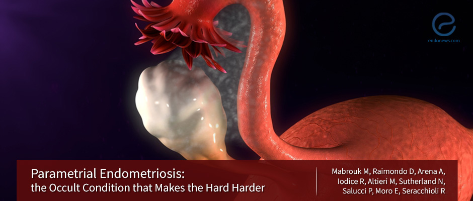Parametrial endometriosis: A harder form of endometriosis