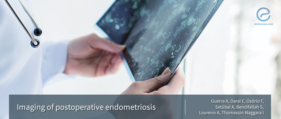 The appearance of postoperative endometriosis by imaging methods 