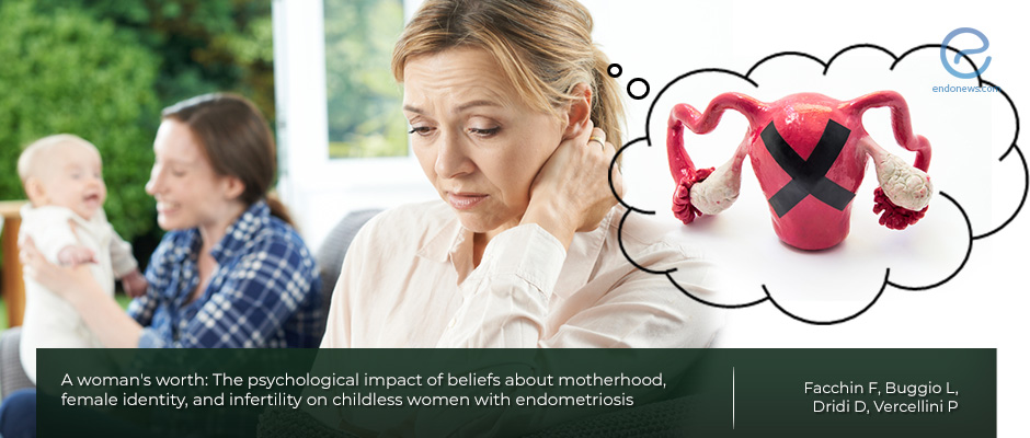 Analysis of childless women with endometriosis