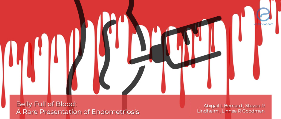 Hemorrhagic Ascites, Belly-Blood: The cause may be endometriosis!