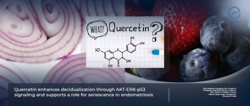 Quercetin and its effects on endometriosis