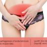 Inflammatory mediators in endometriosis pathogenesis