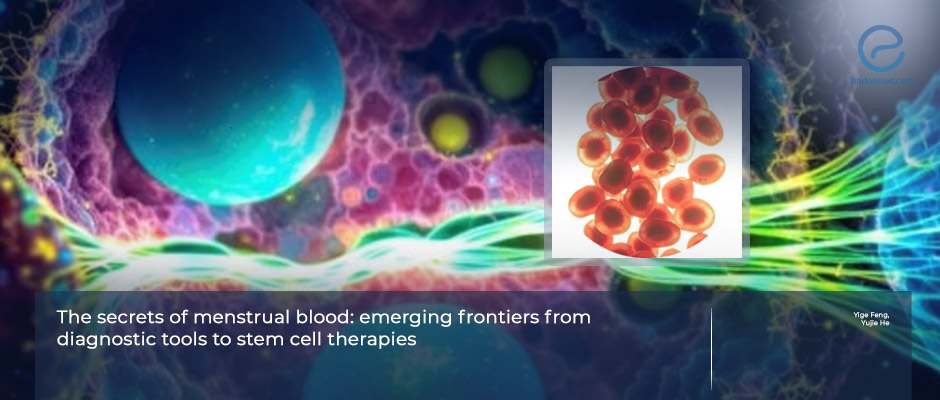 Menstrual Blood–Derived Stem Cells and Diagnostic Advances