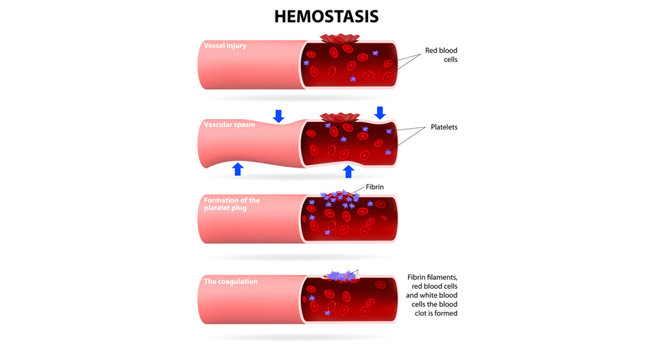 Platelets Promote the Development of Endometriosis