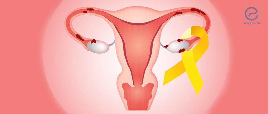 Updates in the Field of Endometriosis