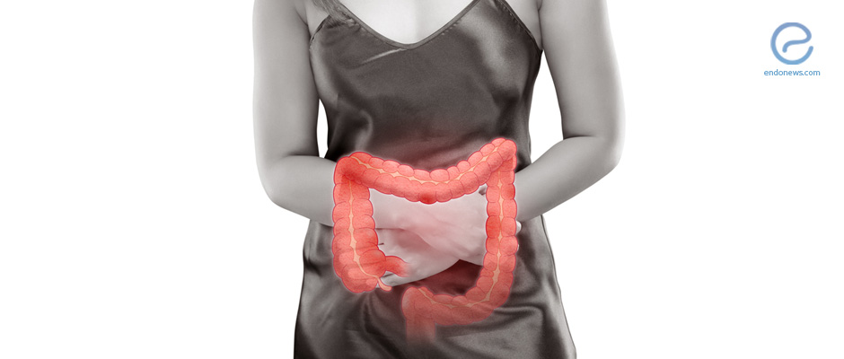Surgical treatment of colonic endometriosis