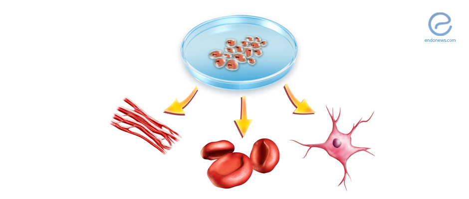 Human Endometrium-Derived Mesenchymal Stem Cells for Cell-based Therapies