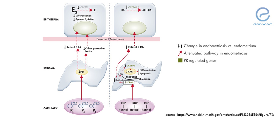 Roles of Progesterone in Endometrial Cancer, Endometriosis, Uterine Fibroids, and Breast Cancer
