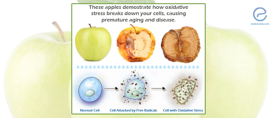 Endometriosis and Oxidative Stress 