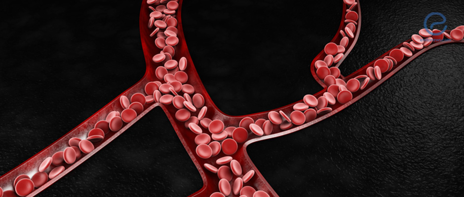 Blood vessels formation in endometriosis