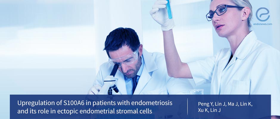 S100A6 May be a Promising Target for Endometriosis Treatments