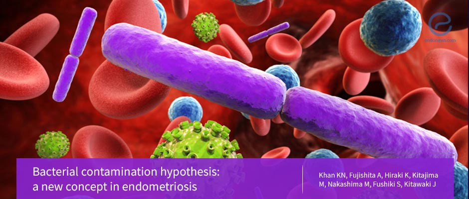 Could Endometriosis Be Caused by Bacteria?