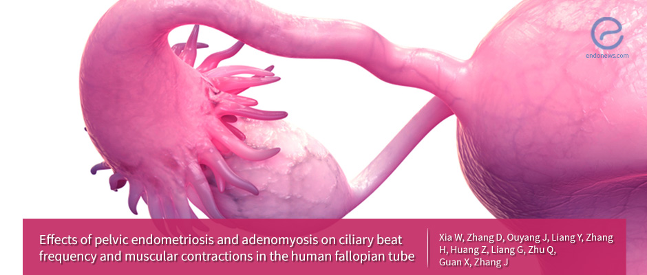 Fallopian Tube Capability in Women with Pelvic Endometriosis and Adenomyosis