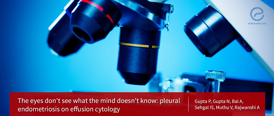 Thoracic Endometriosis Syndrome (TES): Diagnosis by cytology of pleural effusion