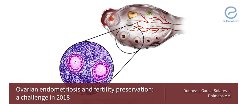 How to preserve fertility in women with “ovarian endometriosis”?