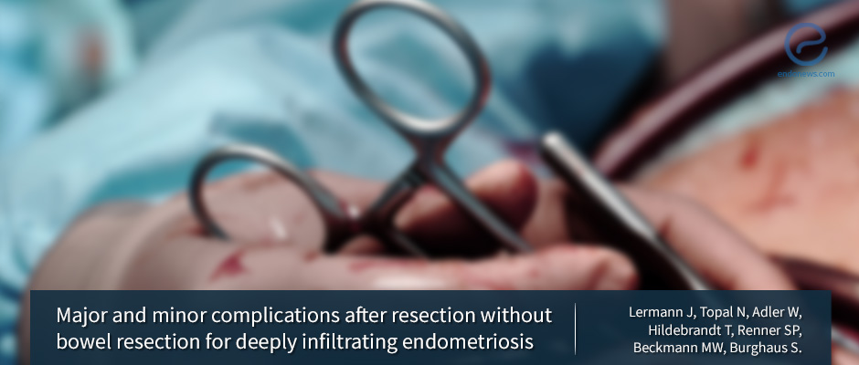 Will I Have Complications After Endo Surgery?