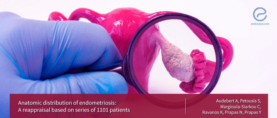 Anatomic distribution of endometriosis