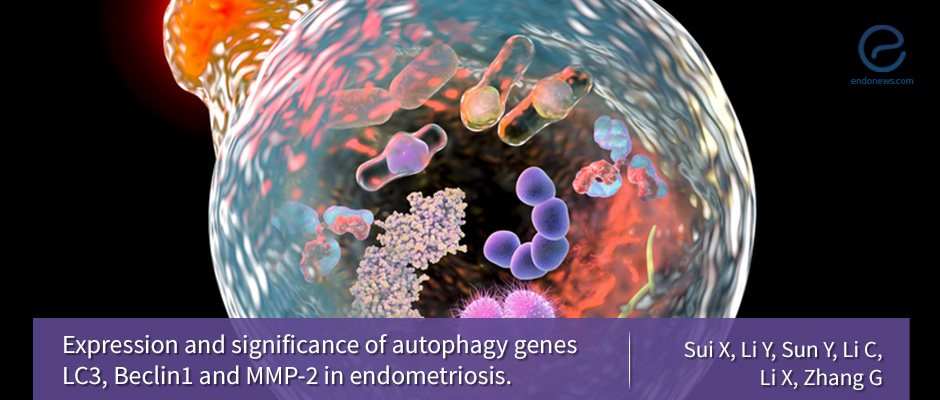 Autophagy, proteolysis and Endometriosis