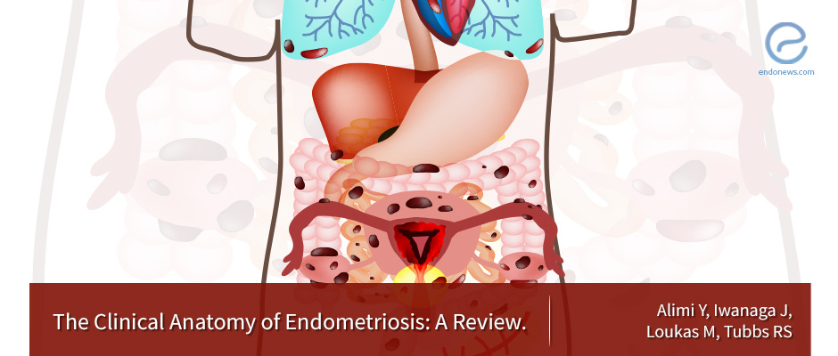 Endometriosis: A review on anatomic principles and the management