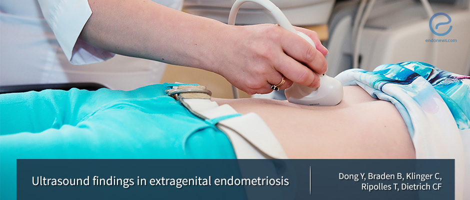 Extragenital endometriosis and ultrasound