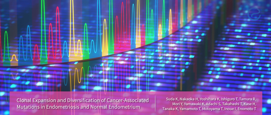 Clonal Proliferation and Cancer Associated Mutations in normal uterine endometrium and endometriosis
