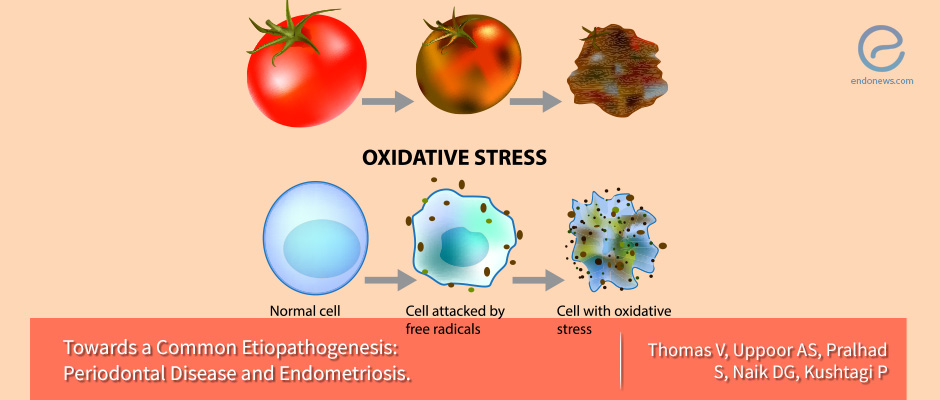 The relationship between periodontal disease and endometriosis