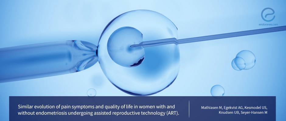 Assistive Reproduction a Suitable Option for the Treatment of Endometriosis-Associated Infertility