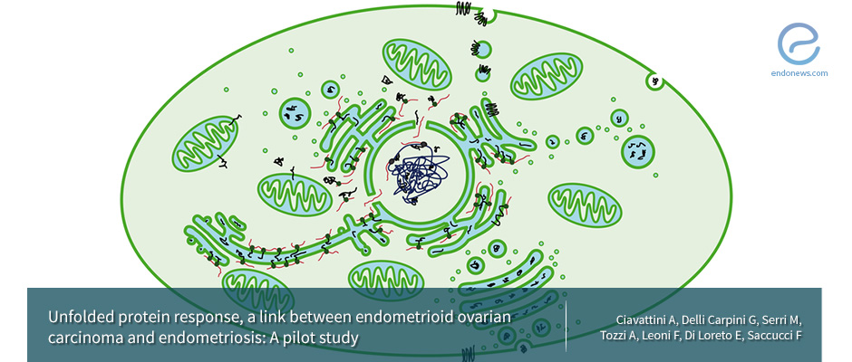 A link between endometrioid ovarian carcinoma and endometriosis.