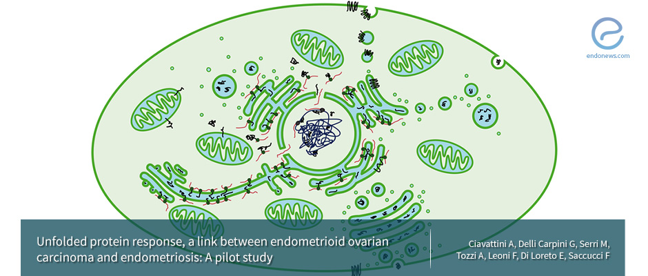 Endometrioid ovarian carcinoma & endometriosis