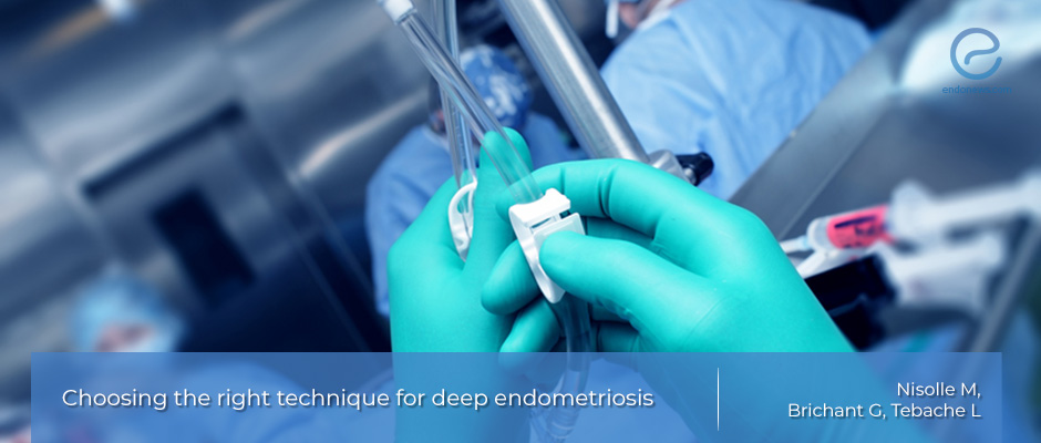 Choosing the Right Technique for Deep Colorectal Endometriosis