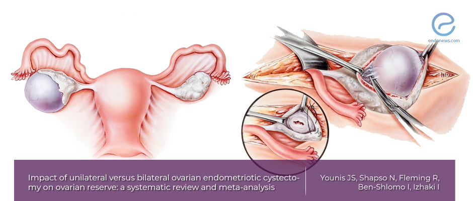 Antimullerian Hormone, endometrioma and ovarian reserve