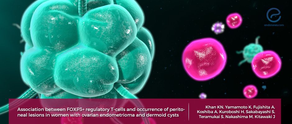 Correlation between Treg cells and peritoneal lesions in women with ovarian endometrioma