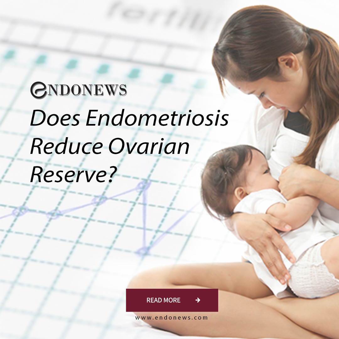 Does Endometriosis Reduce Ovarian Reserve? EndoNews