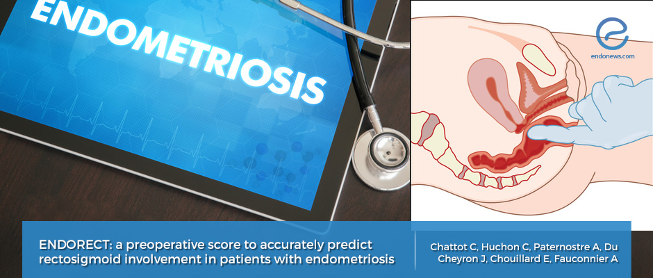 ENDORECT scoring system to identify patients at risk for rectosigmoid endometriosis