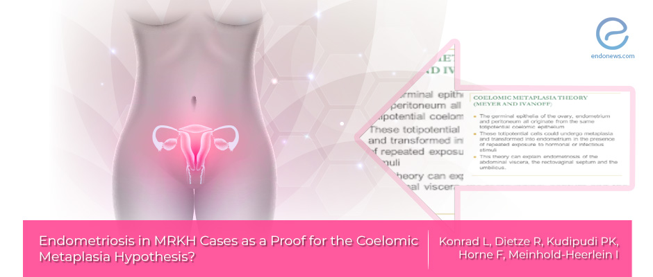 The coelomic metaplasia hypothesis of endometriosis in MRKH cases