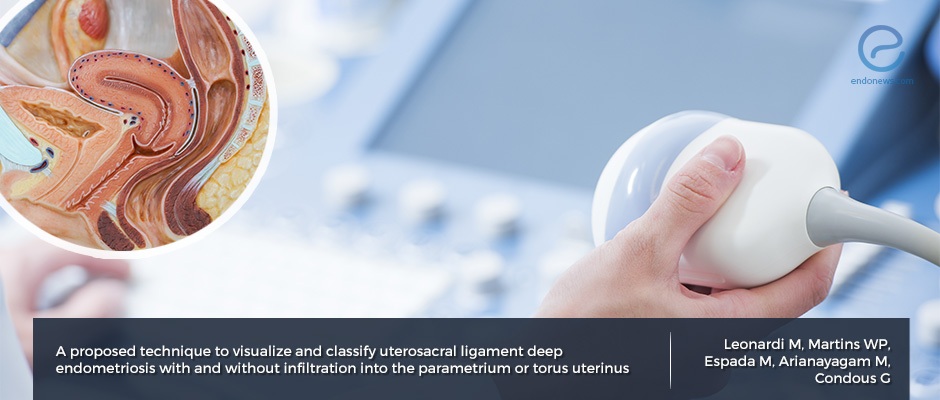 Transvaginal Ultrasound and the Imaging of Endometriosis