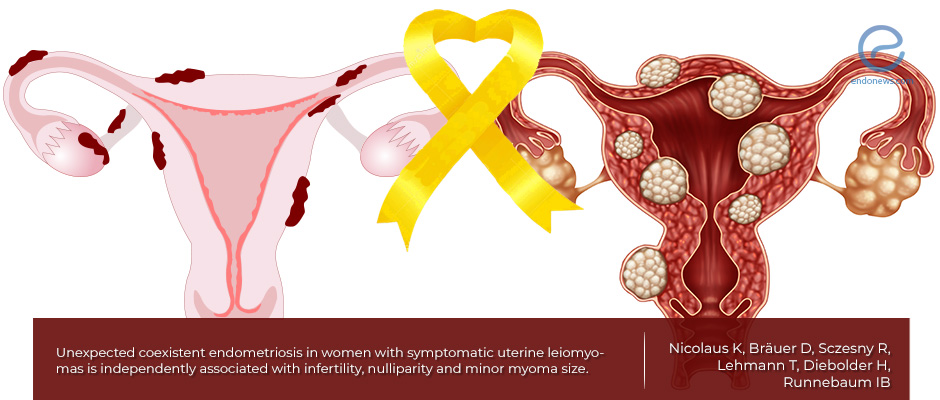 Frontiers  Endometriosis and Uterine Fibroids (Leiomyomata