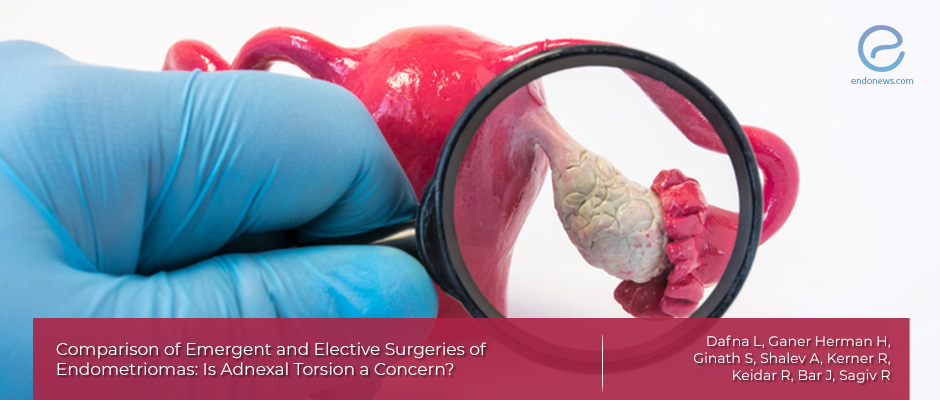 A study about adnexial torsion doubts in patients with endometriosis.