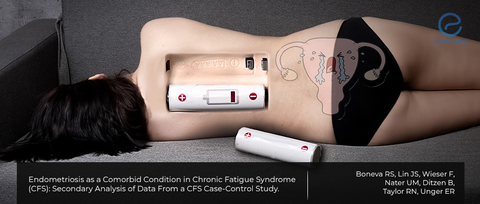 Chronic Fatigue Syndrome and Endometriosis: Comorbid Conditions