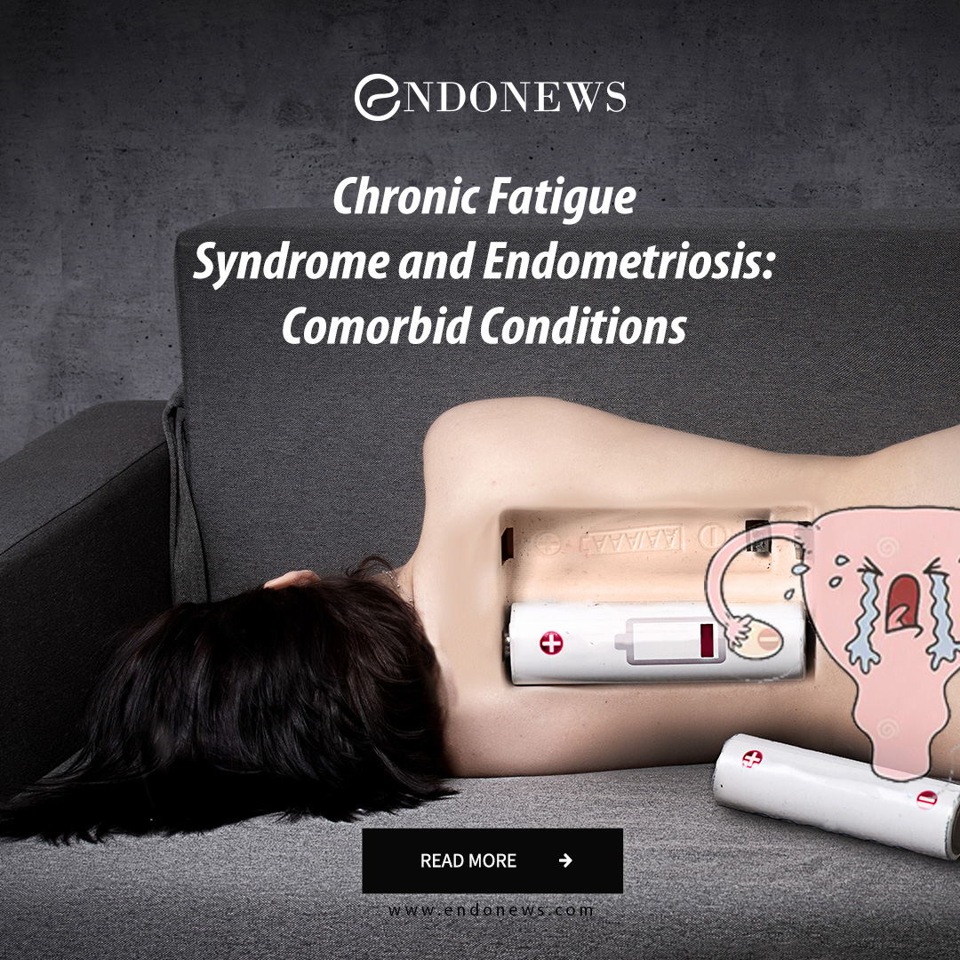 Chronic Fatigue Syndrome And Endometriosis Comorbid Conditions Endonews