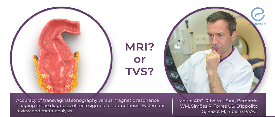 MRI or TVS for accurate diagnosis of rectosigmoid endometriosis?