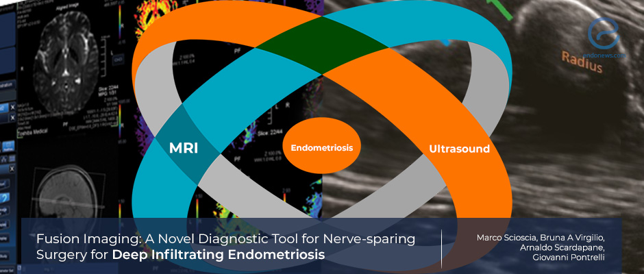 Fusion US/MR imaging in the evaluation of deep infiltrating endometriosis