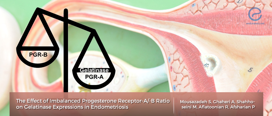 The Effect of Imbalanced Progesterone Receptors-A/B on Gelatinase Expressions in Endometriosis