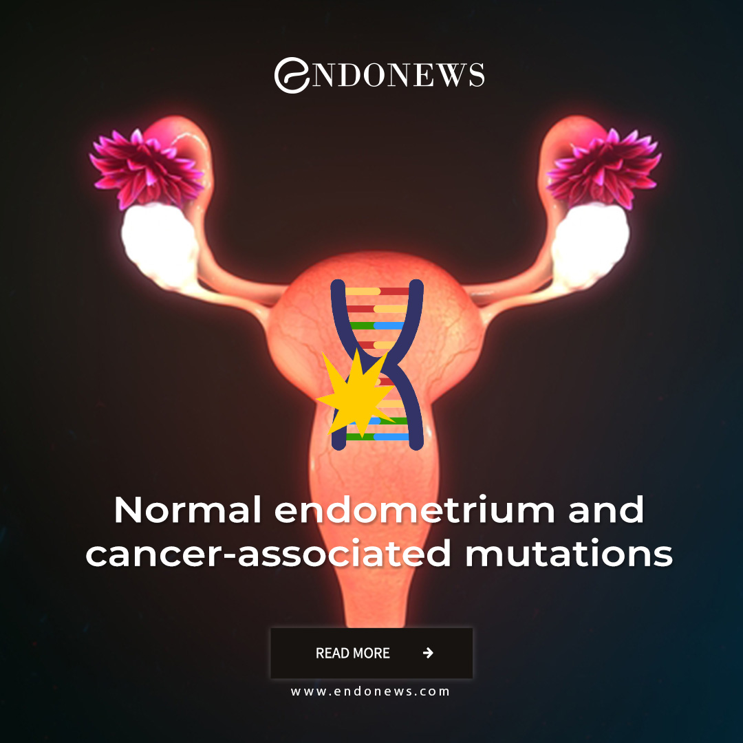 Normal endometrium and cancerassociated mutations EndoNews