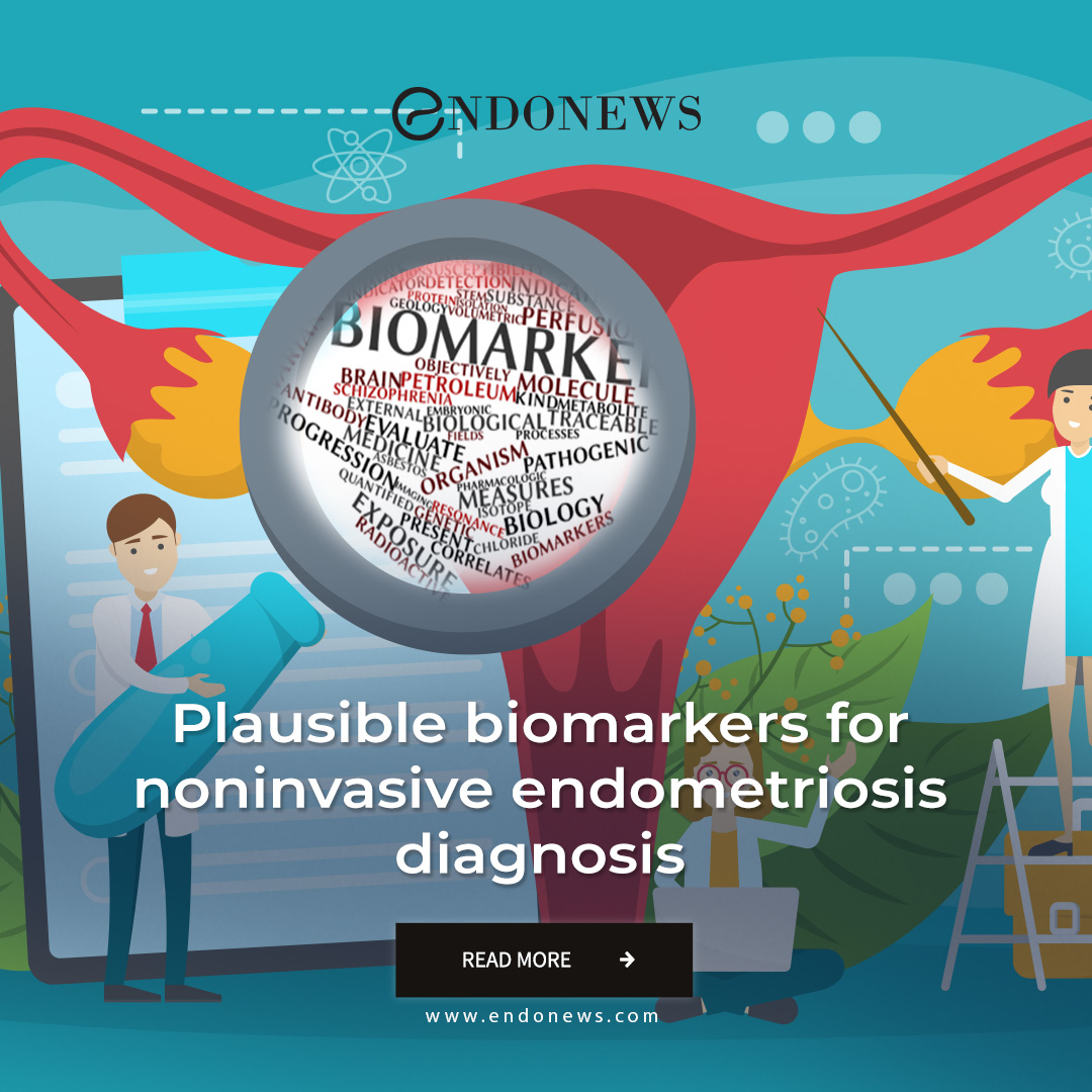 Plausible biomarkers for noninvasive endometriosis diagnosis | EndoNews