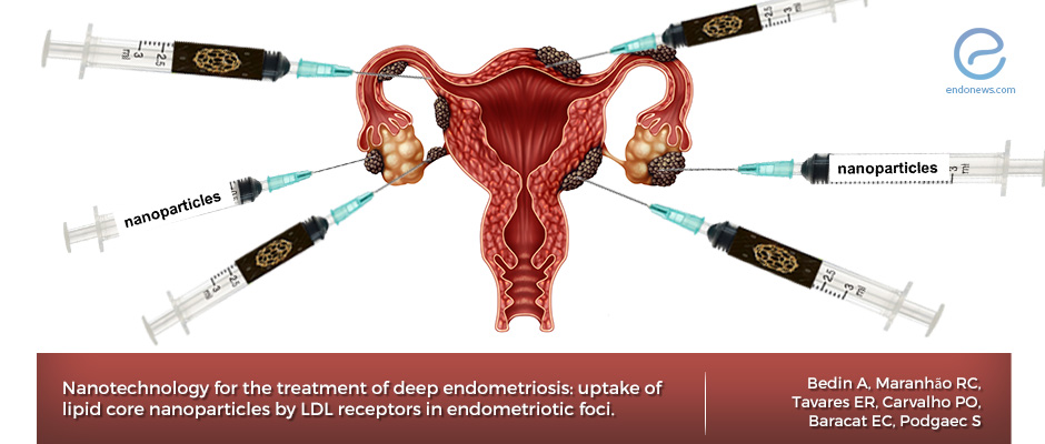 Nanotechnology as a tool for targeted therapy of endometriosis