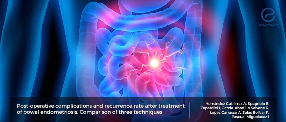 Which surgical approach for bowel endometriosis?