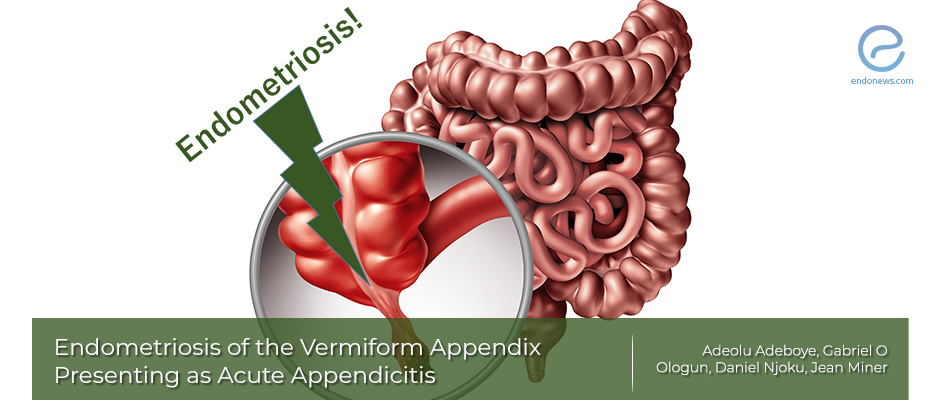 Endometriosis of the Appendix