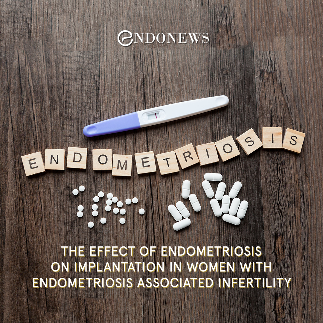 The effect of endometriosis on implantation in women with endometriosis associated infertility