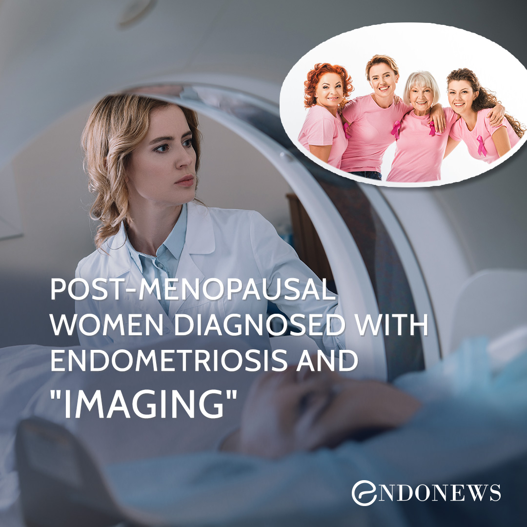 Postmenopausal women diagnosed with Endometriosis and "Imaging" EndoNews